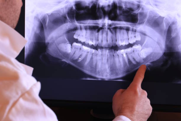Best Mobile Emergency Dentist in Potomac Park, CA