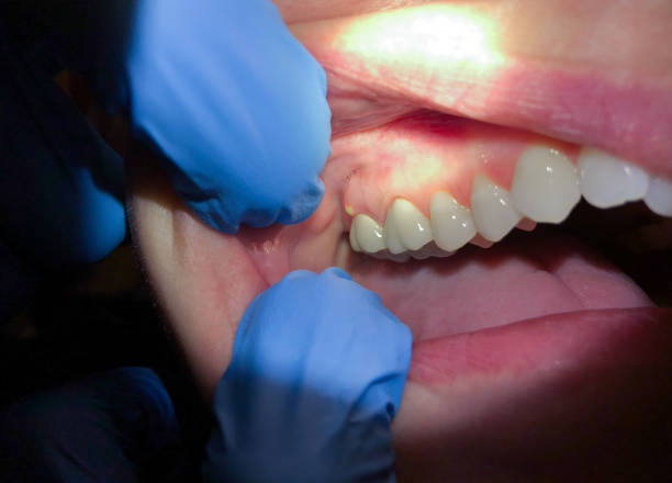 Best Emergency Root Canal Treatment in Potomac Park, CA