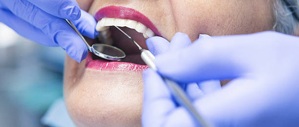 Best Emergency Dental Extractions in Potomac Park, CA